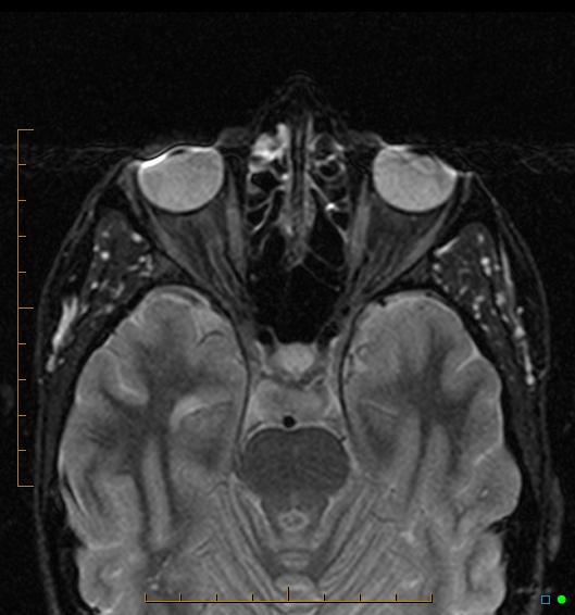 Who is radiographer?